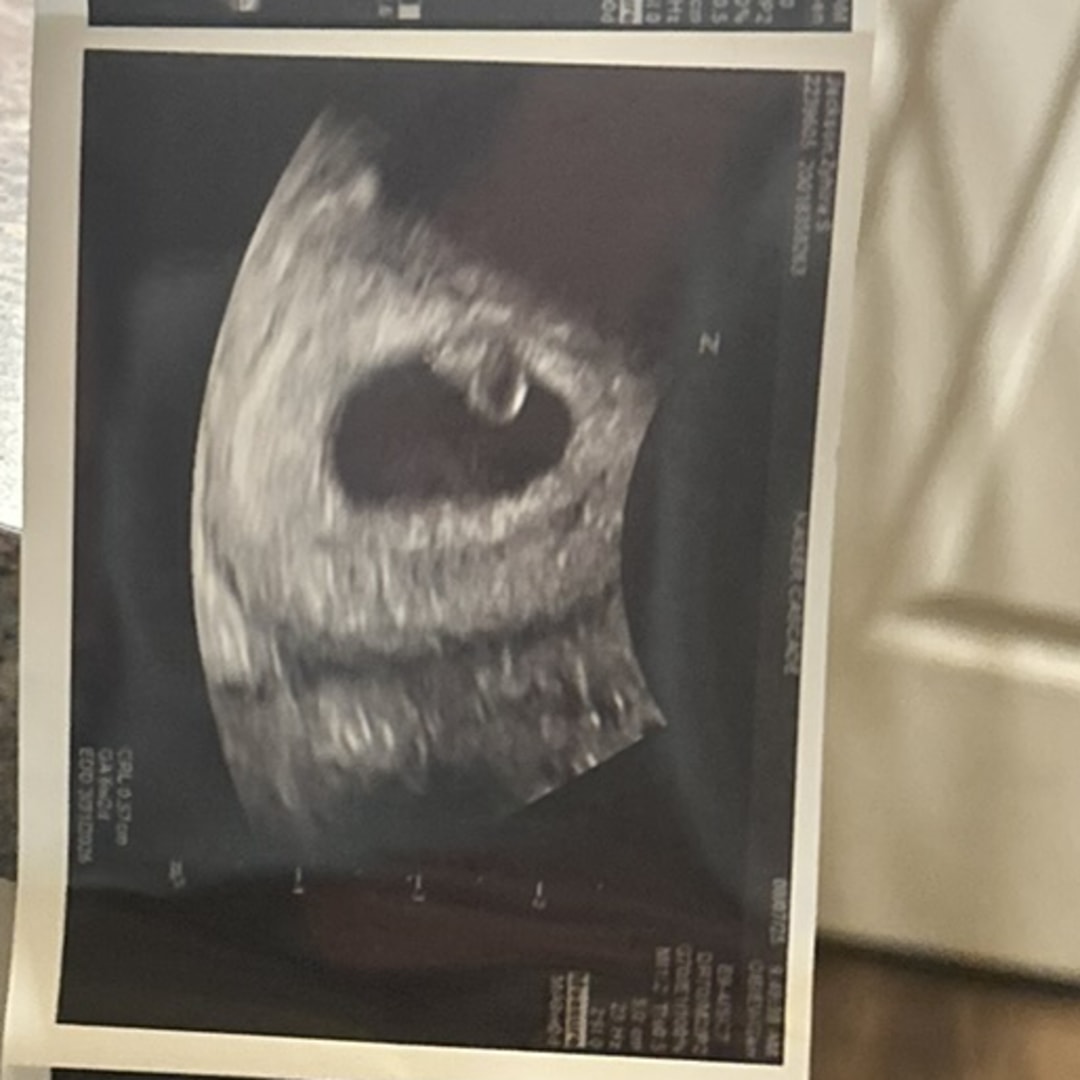 Photo shared by Zyhira for their Babylist baby registry.