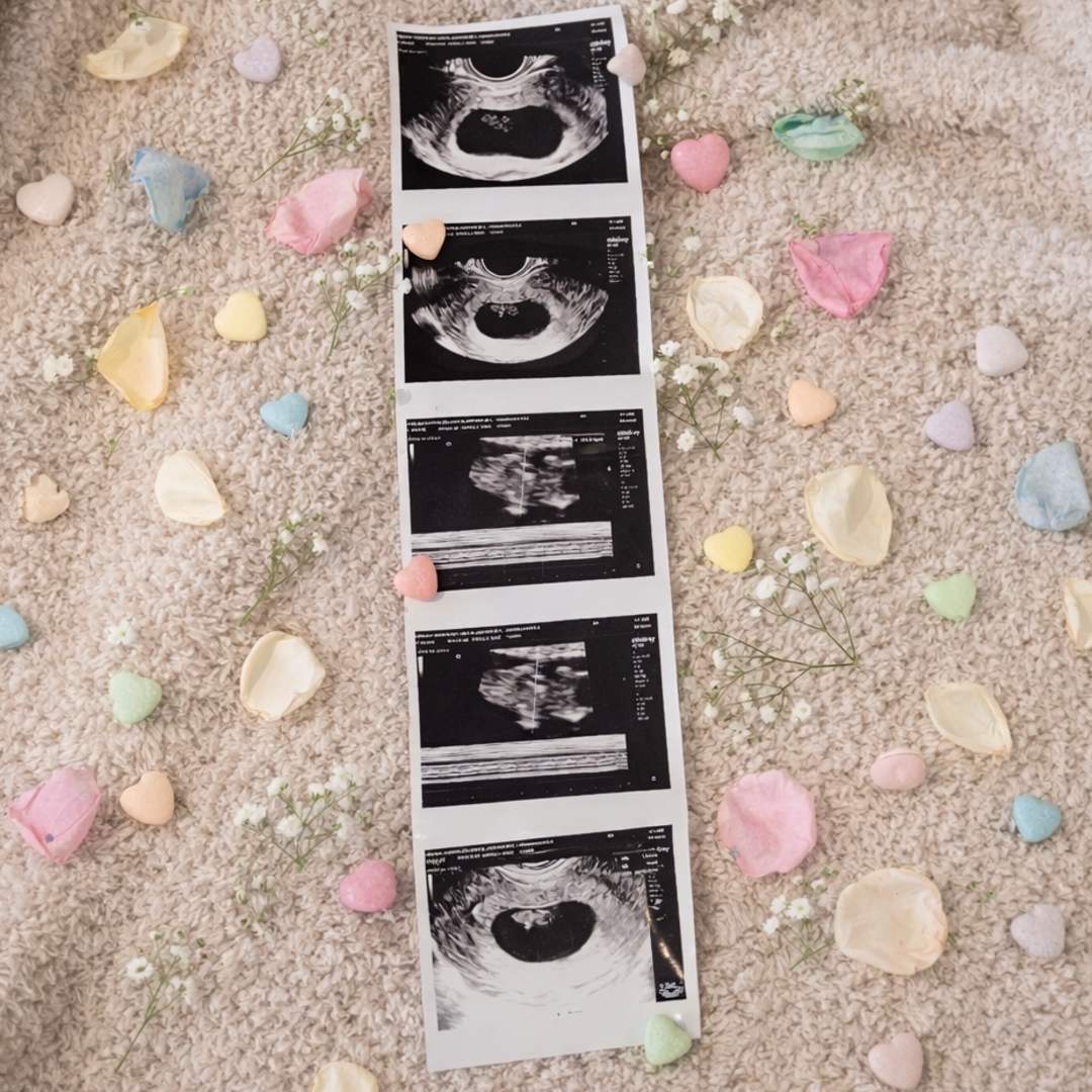 Photo shared by Eve for their Babylist baby registry.