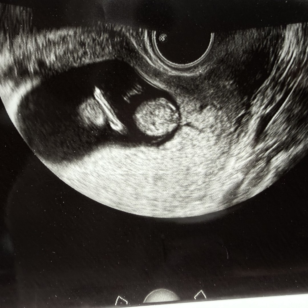 Photo shared by Lidice for their Babylist baby registry.