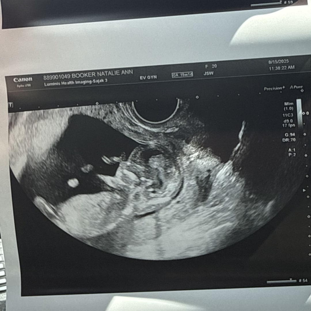 Photo shared by Natalie for their Babylist baby registry.