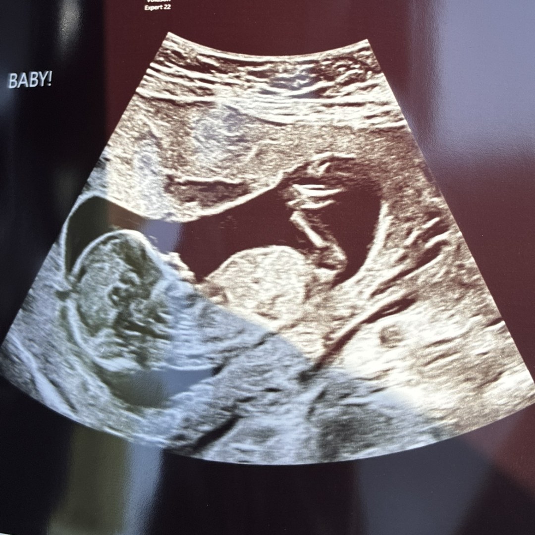 Photo shared by Katie for their Babylist baby registry.