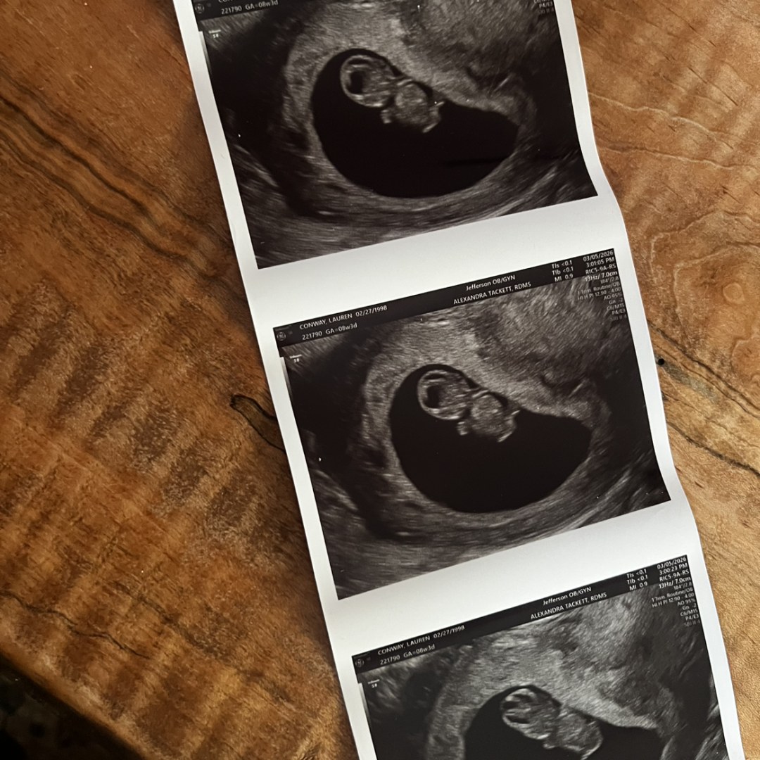 Photo shared by Lauren for their Babylist baby registry.