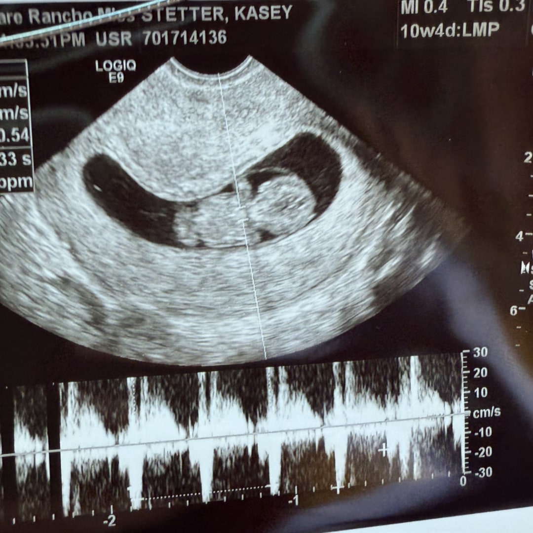 Photo shared by Kasey for their Babylist baby registry.