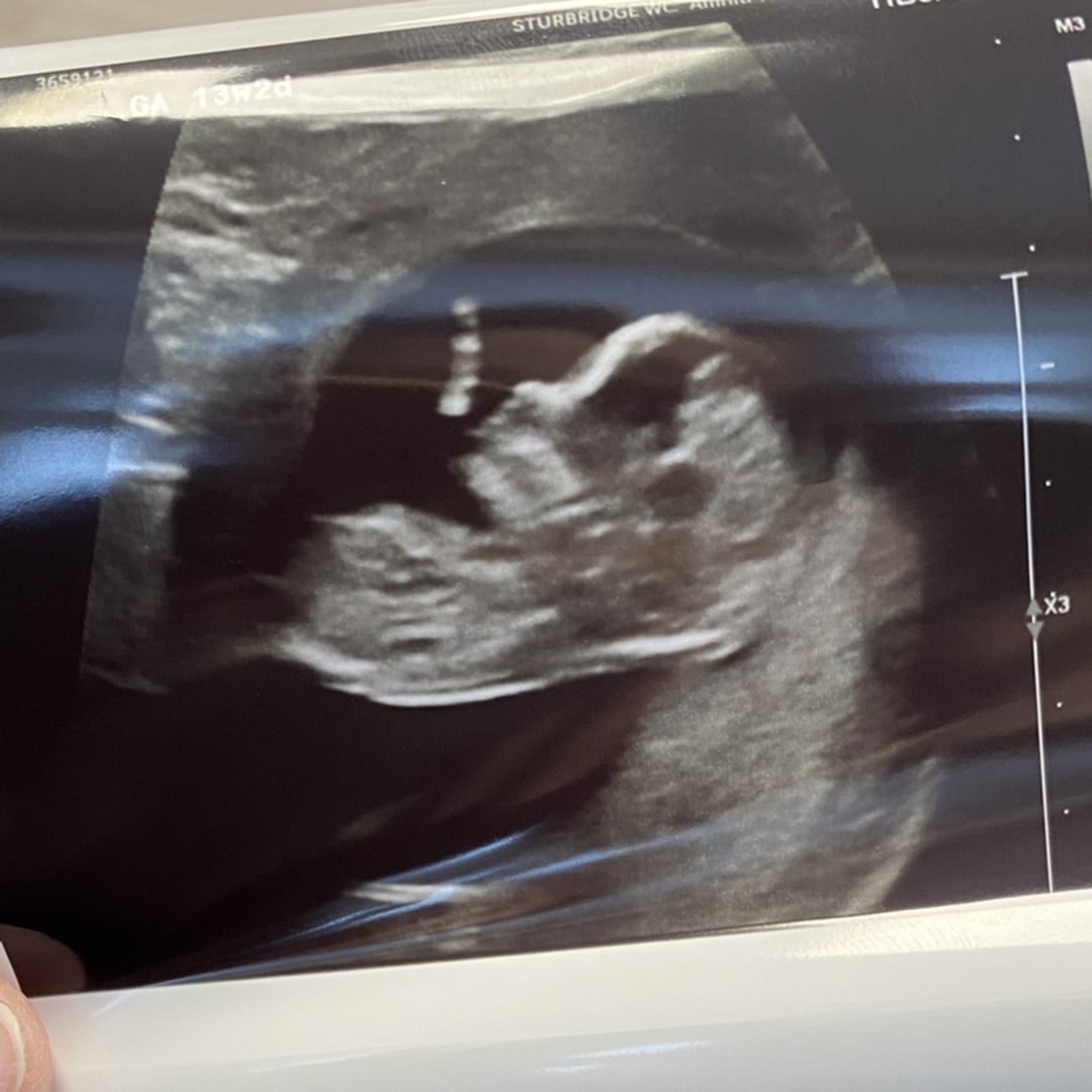 Photo shared by Holly for their Babylist baby registry.