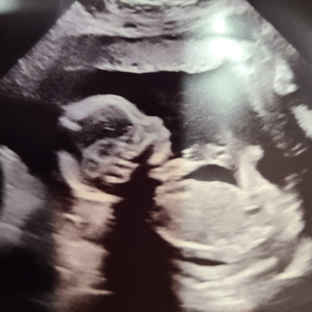 Photo shared by Hannah for their Babylist baby registry.