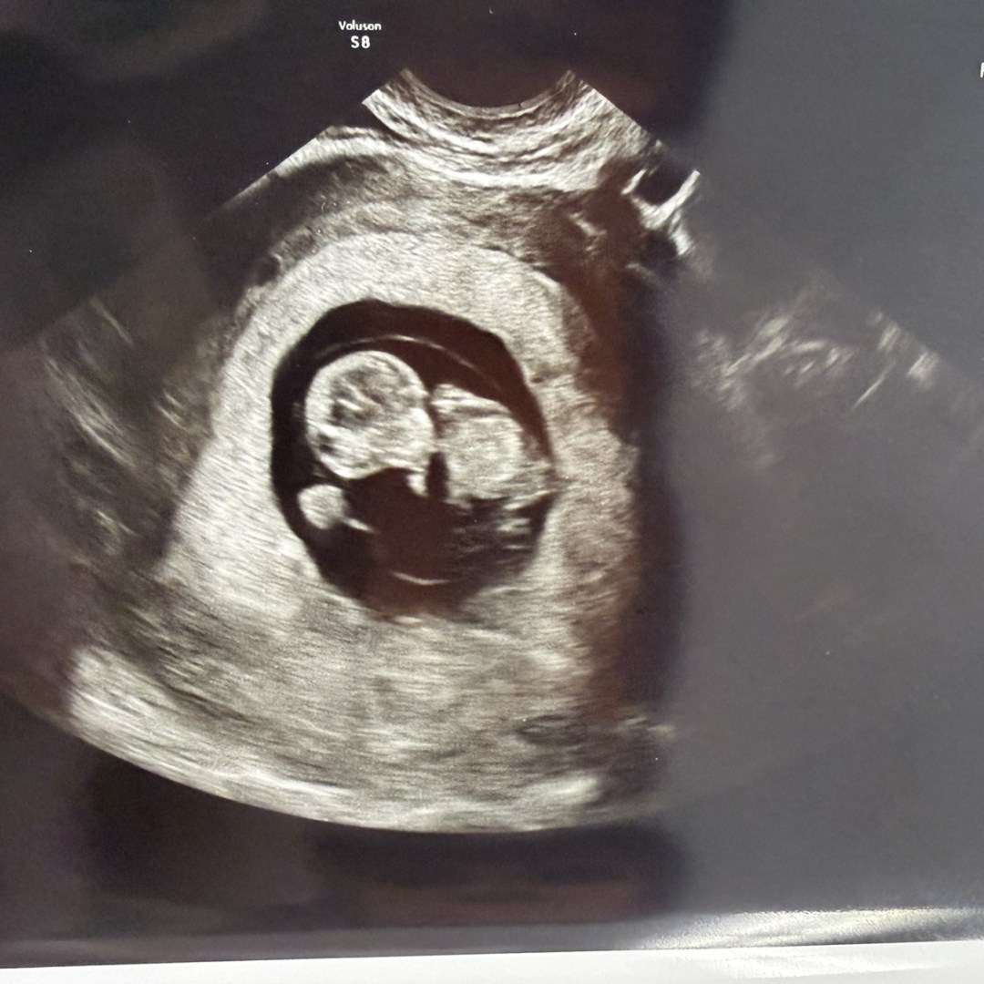 Photo shared by Sarah for their Babylist baby registry.