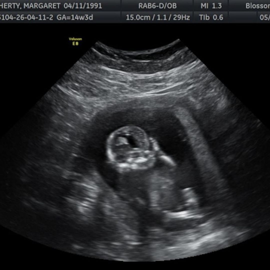 Photo shared by Margaret for their Babylist baby registry.