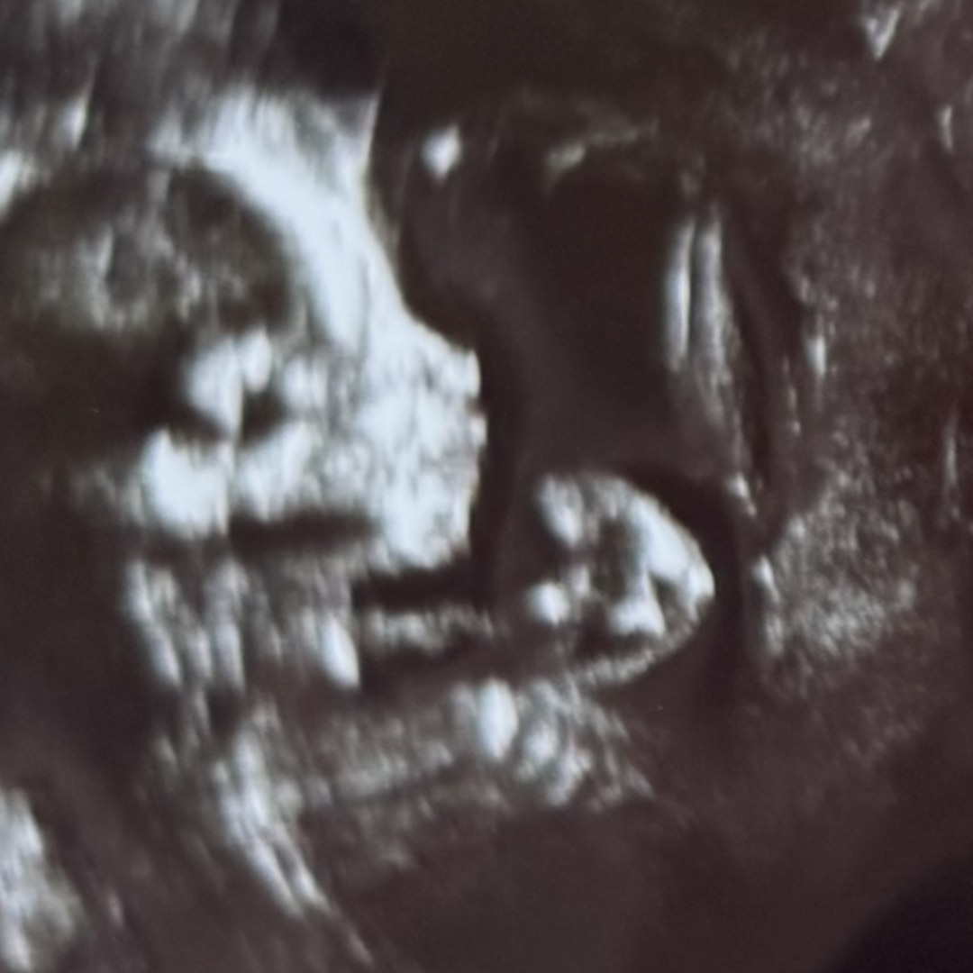 Photo shared by Samantha for their Babylist baby registry.