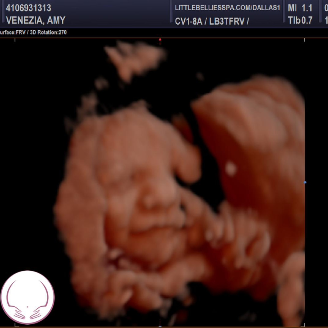 Photo shared by Amy for their Babylist baby registry.