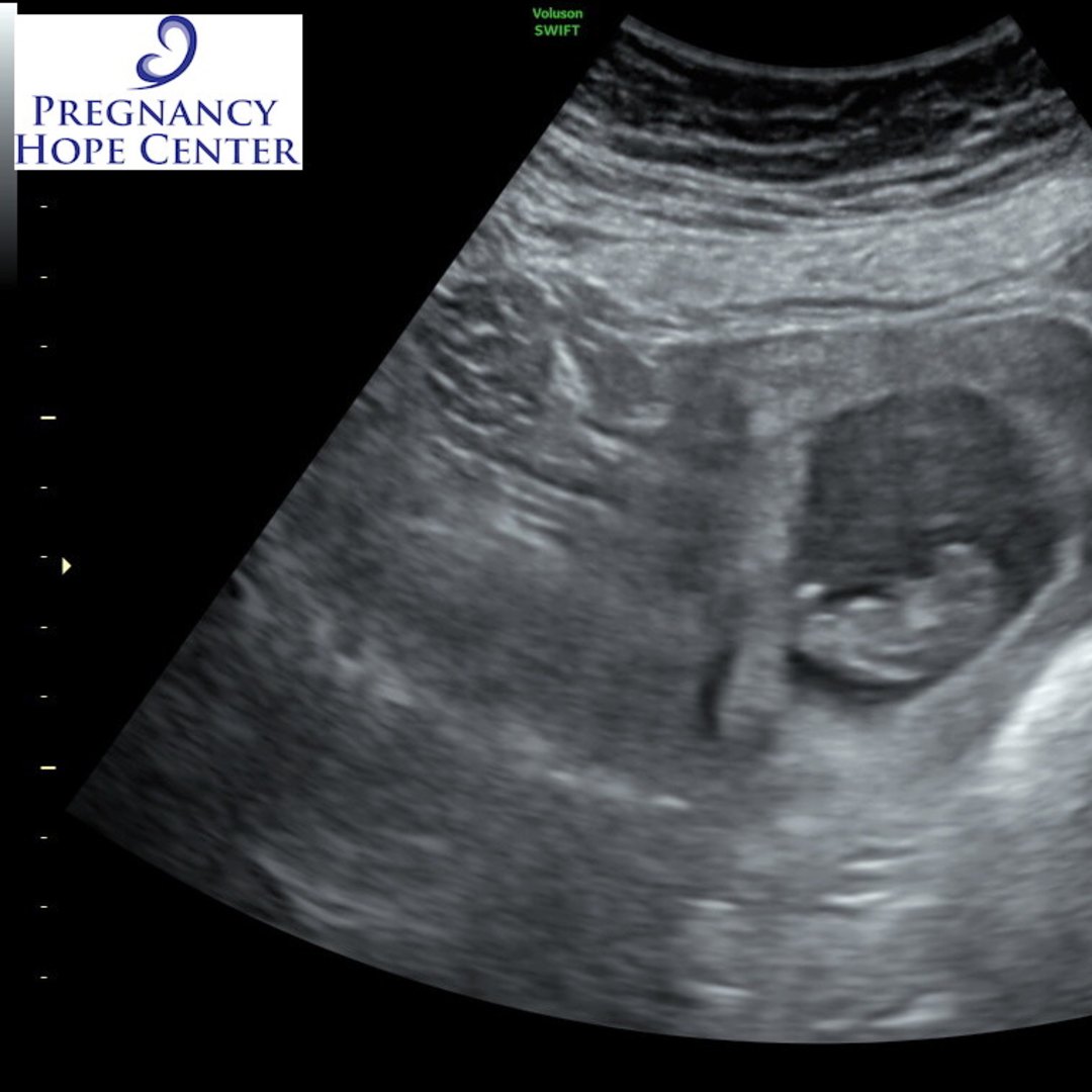 Photo shared by Rebekalyn for their Babylist baby registry.