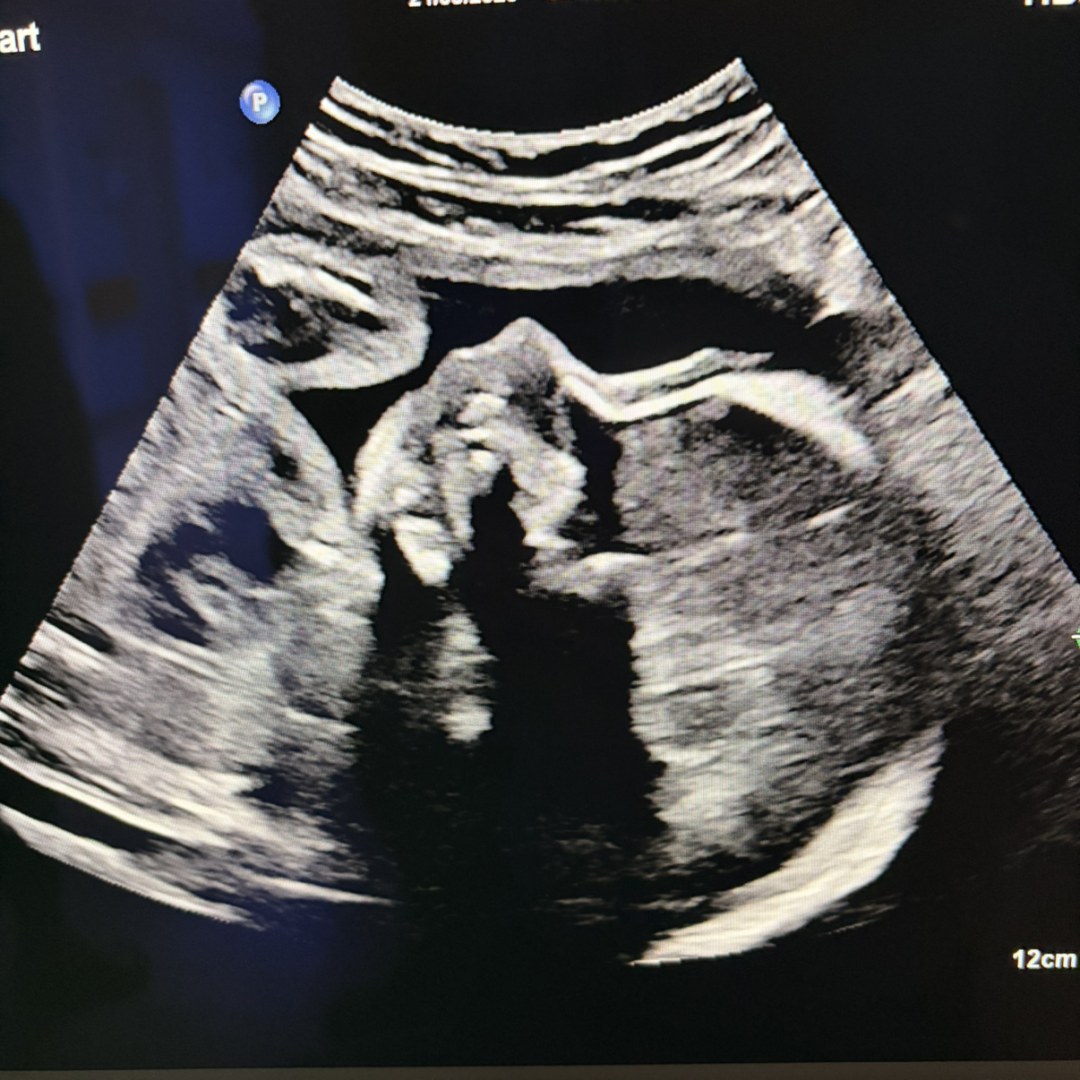 Photo shared by Brittany for their Babylist baby registry.