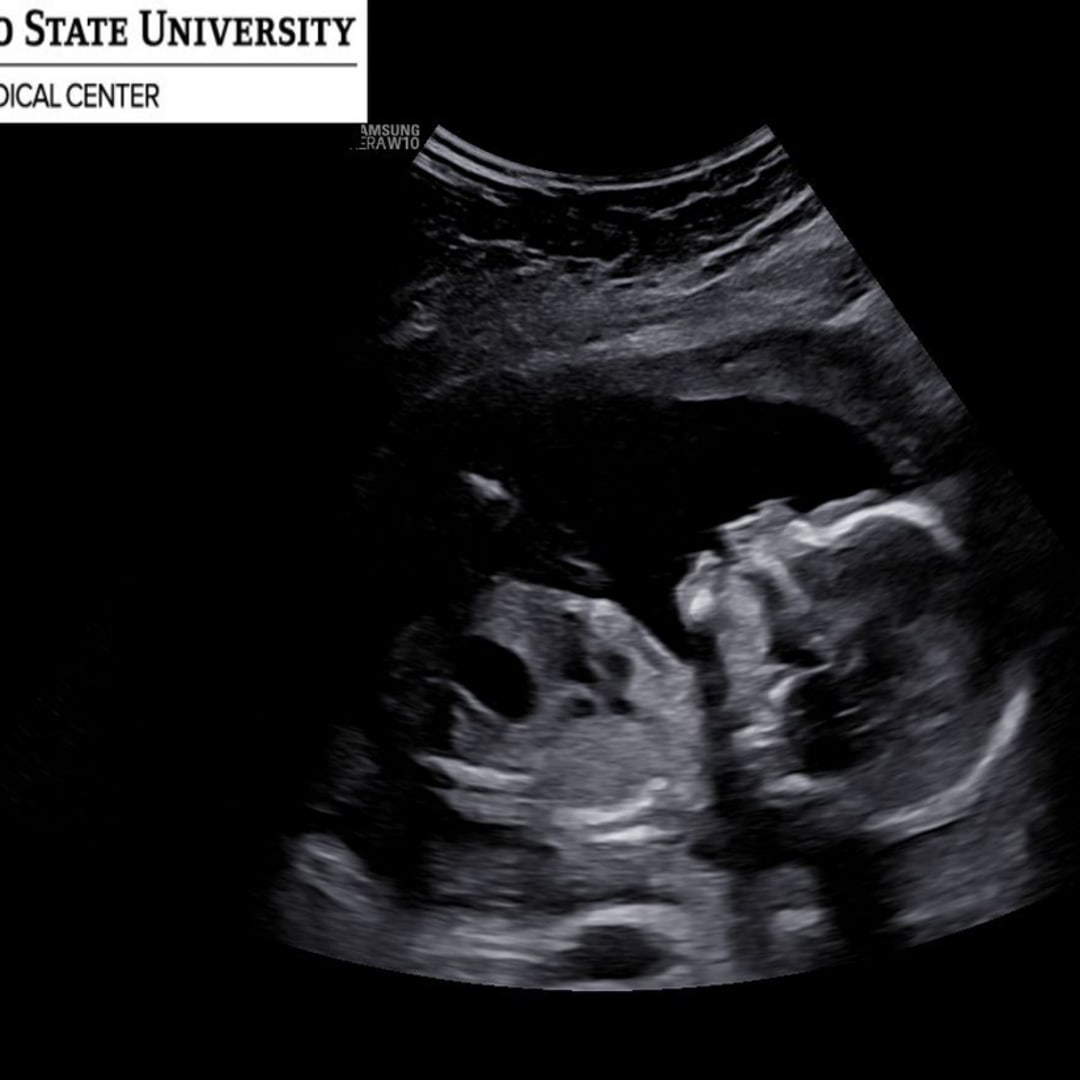 Photo shared by Julia for their Babylist baby registry.