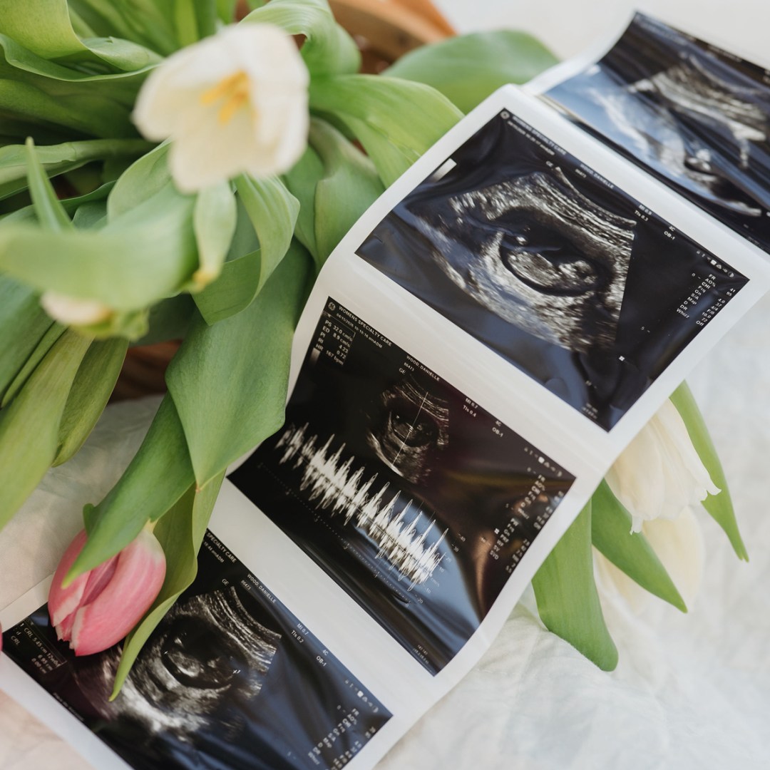 Photo shared by Danielle for their Babylist baby registry.