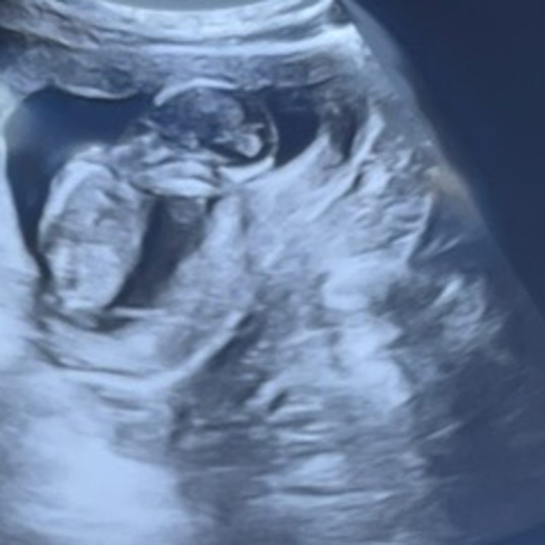 Photo shared by Ziamond for their Babylist baby registry.