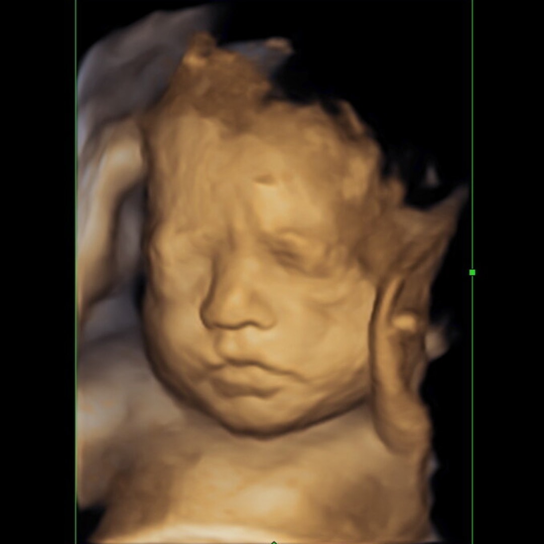 Photo shared by Jasmine for their Babylist baby registry.