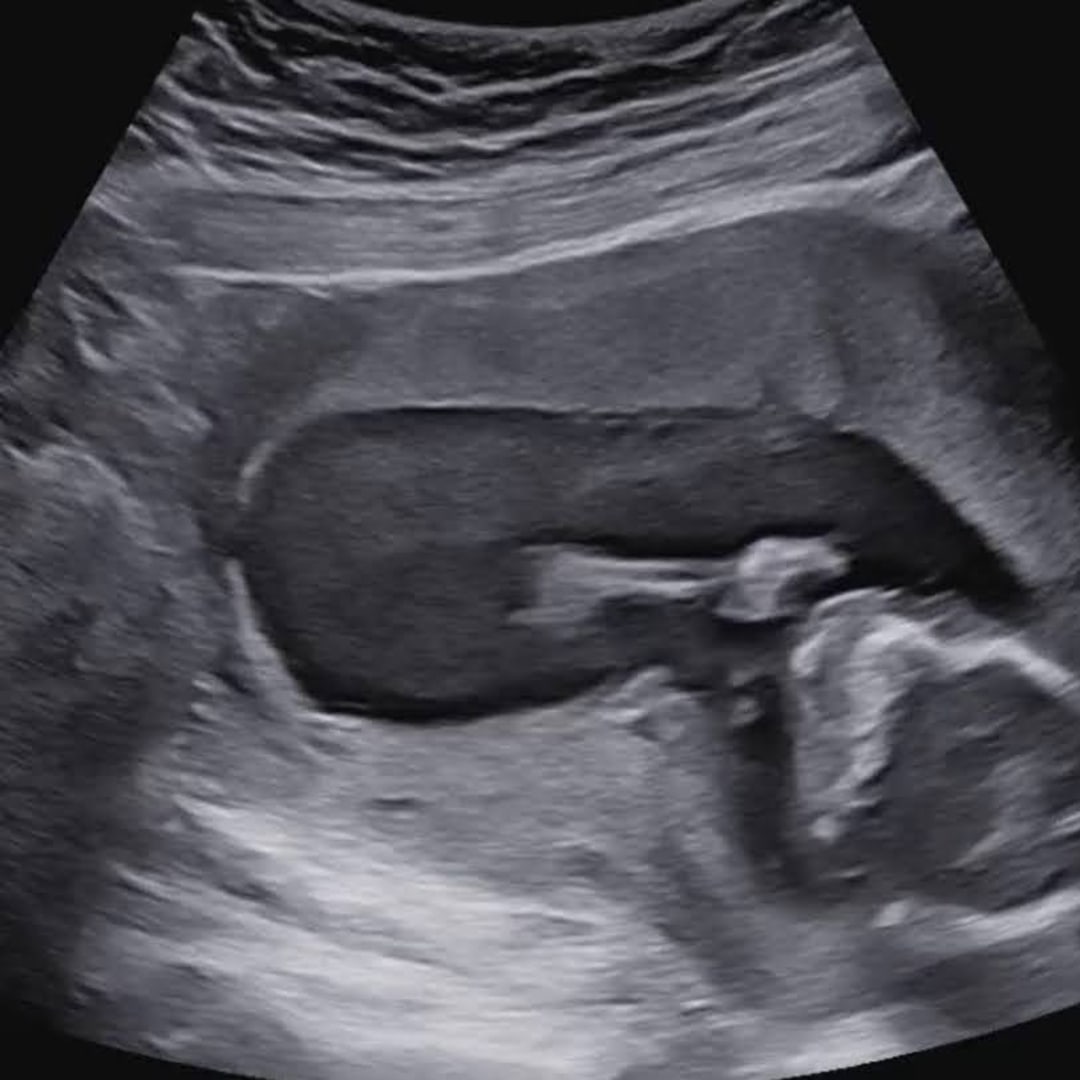 Photo shared by Morgan for their Babylist baby registry.