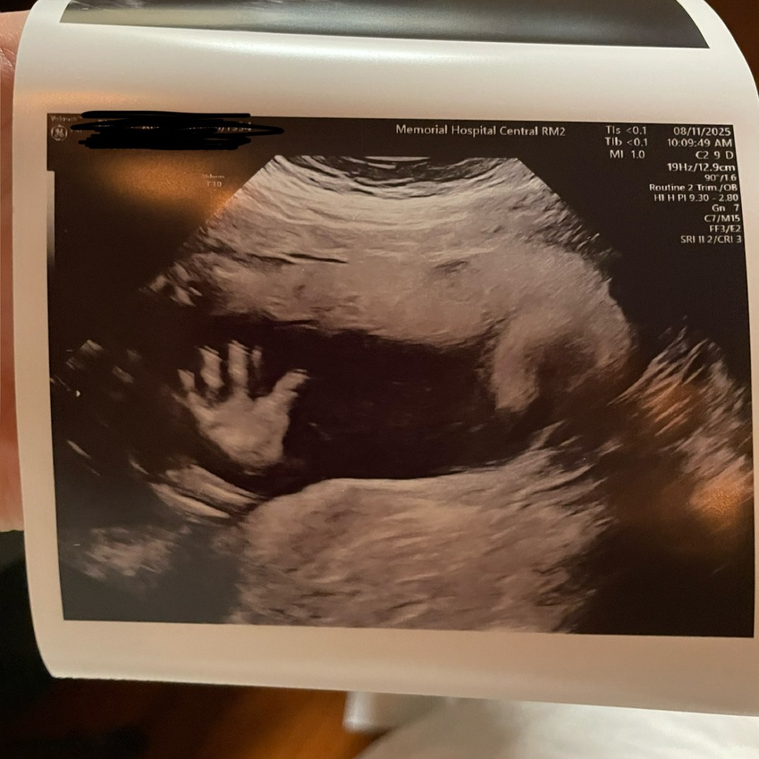 Photo shared by Katie for their Babylist baby registry.