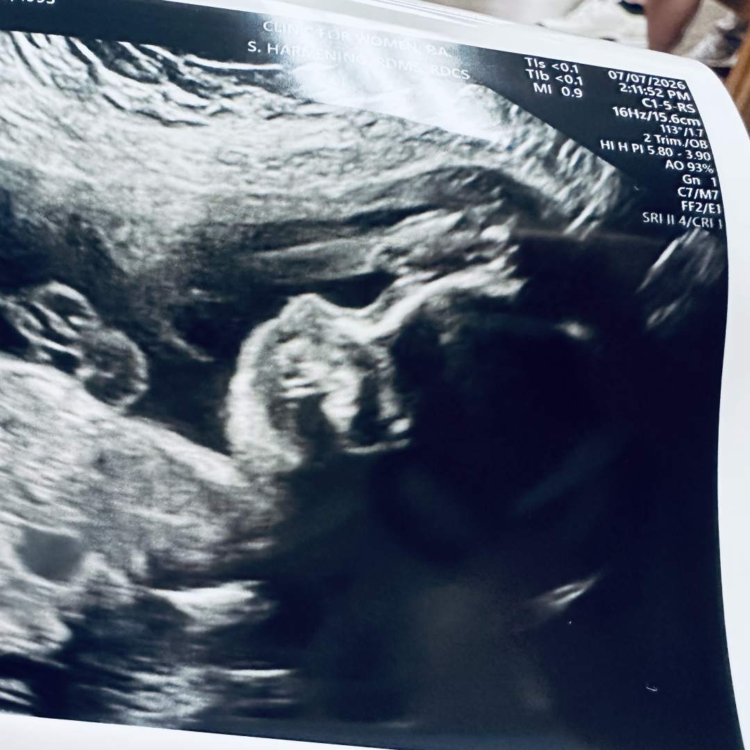 Photo shared by Adrienne for their Babylist baby registry.