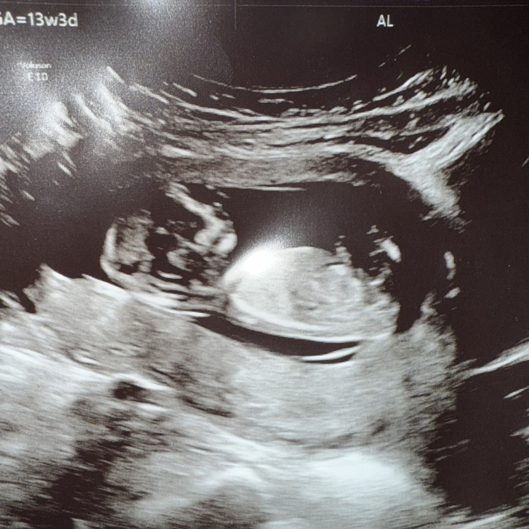 Photo shared by Jocelyn for their Babylist baby registry.