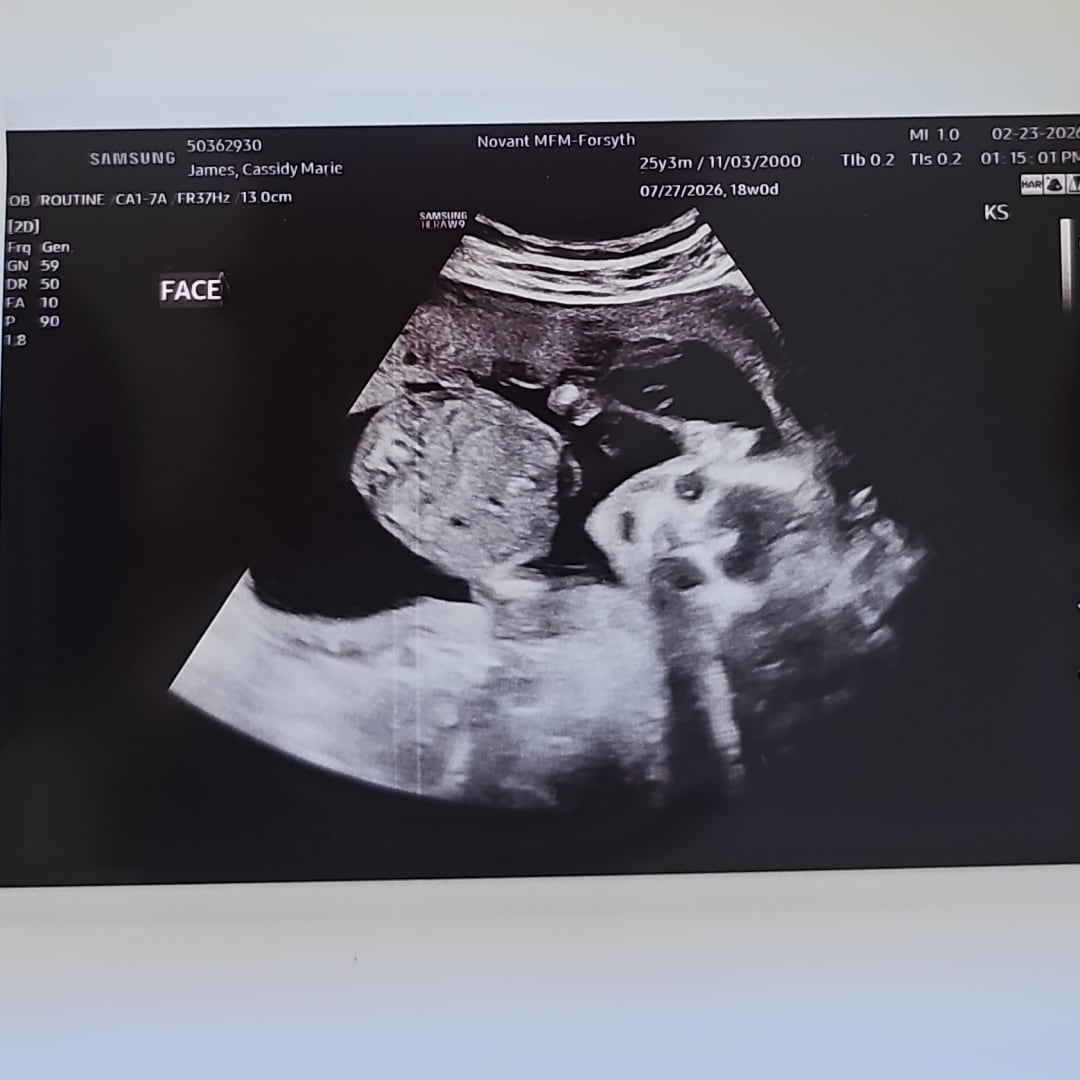 Photo shared by Cassidy for their Babylist baby registry.