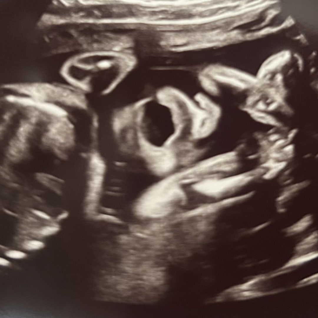 Photo shared by Shanice for their Babylist baby registry.