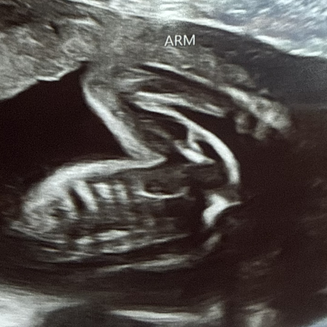 Photo shared by Krista for their Babylist baby registry.