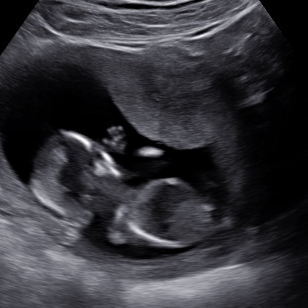 Photo shared by Brandi for their Babylist baby registry.
