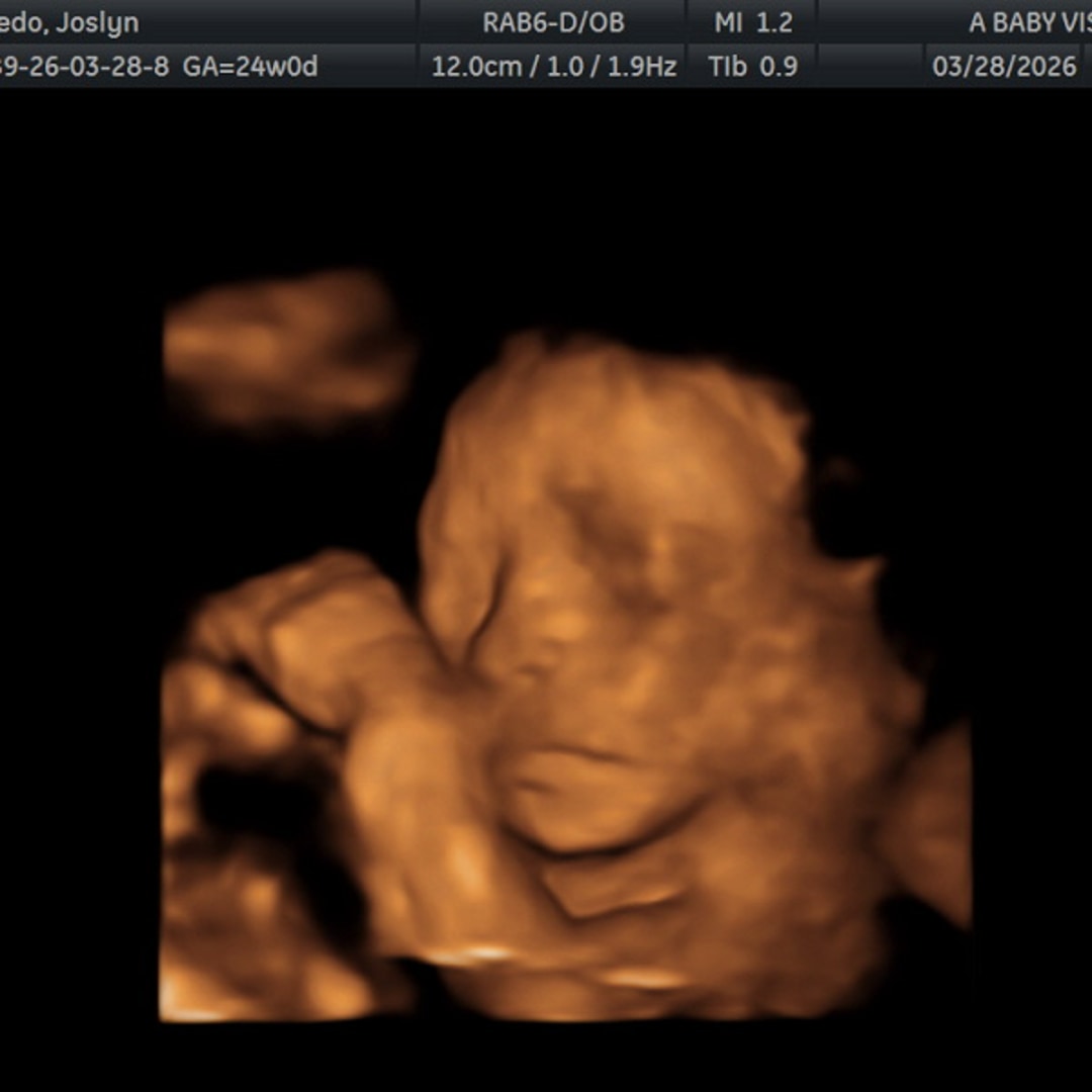 Photo shared by Joslyn for their Babylist baby registry.