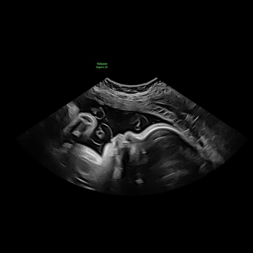 Photo shared by Ashlynne for their Babylist baby registry.