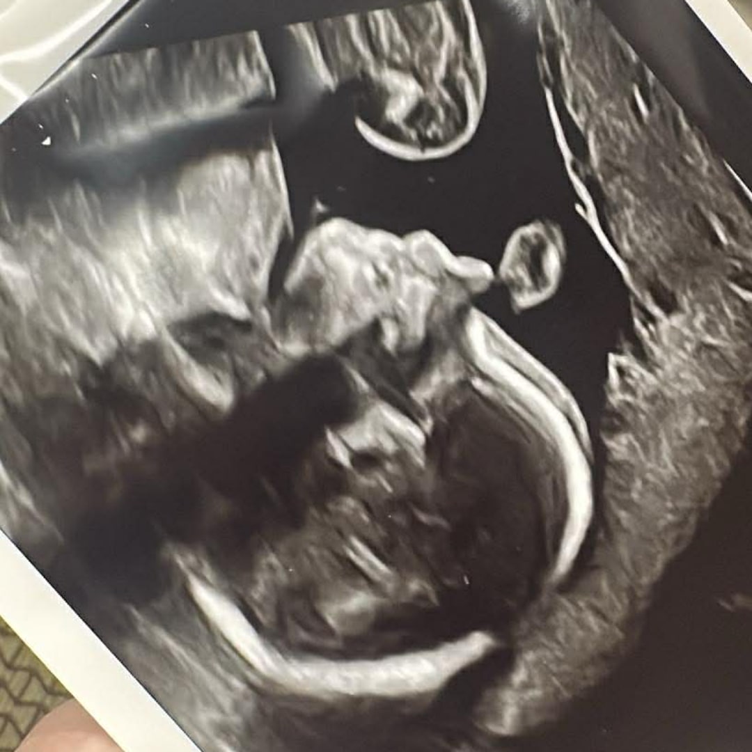 Photo shared by Ashley for their Babylist baby registry.