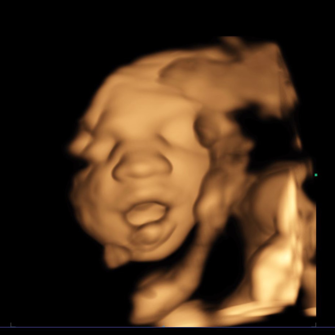 Photo shared by Cassidy for their Babylist baby registry.