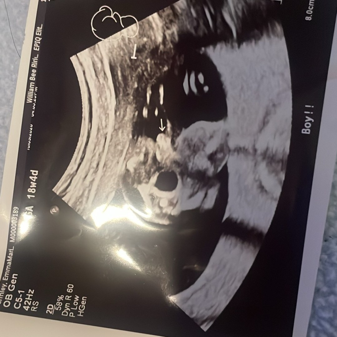 Photo shared by Emmma for their Babylist baby registry.