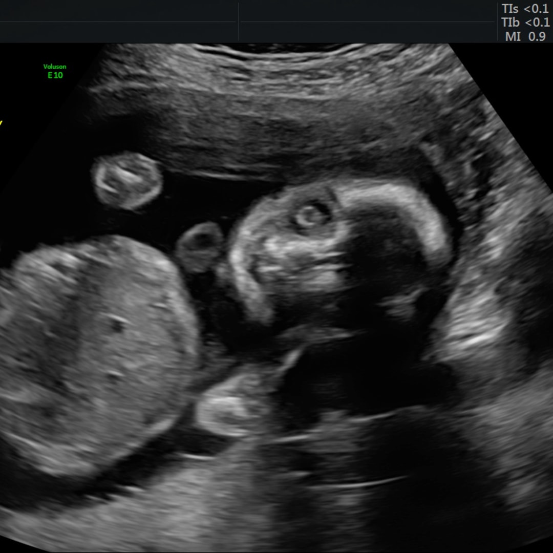 Photo shared by Sarah for their Babylist baby registry.