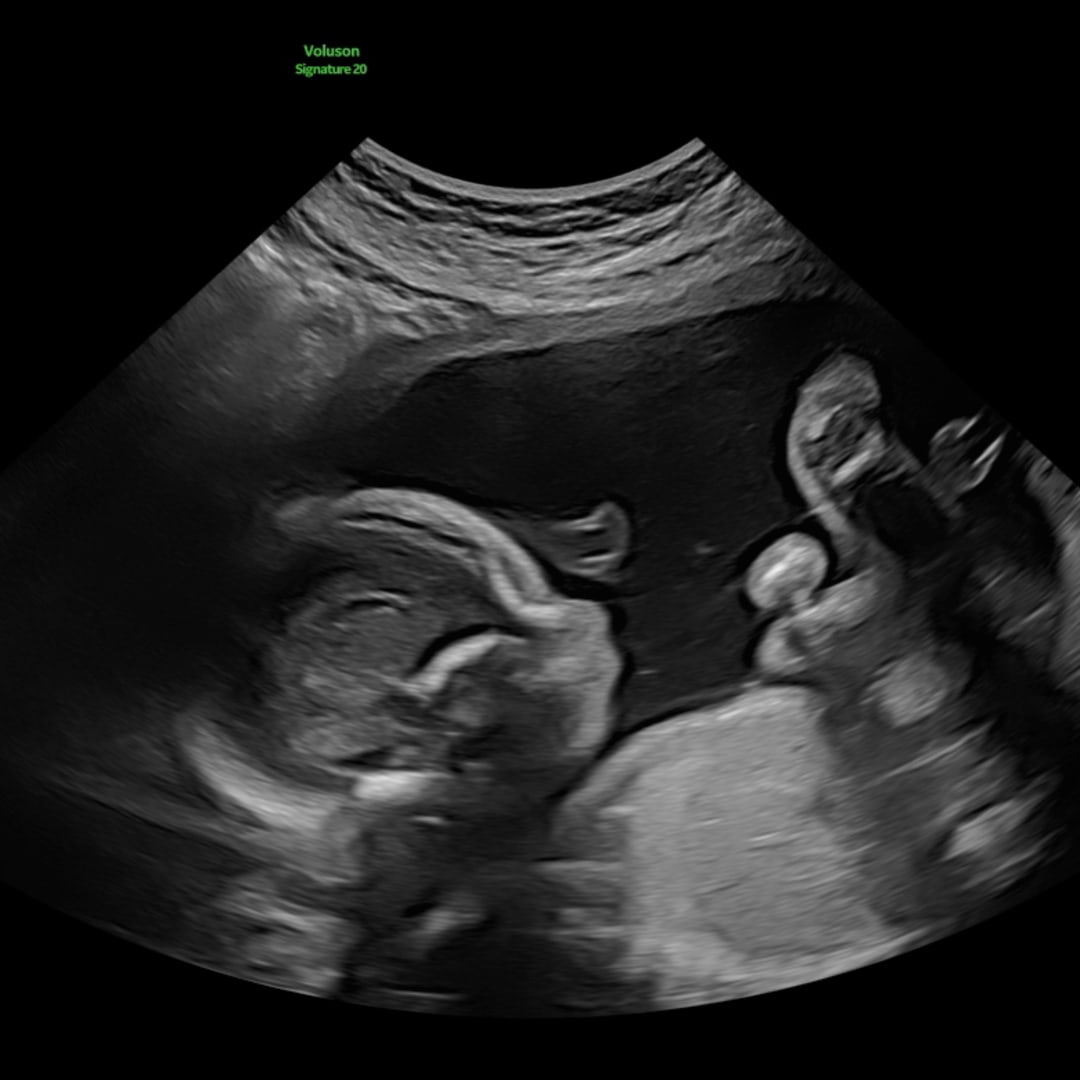 Photo shared by Jaycie for their Babylist baby registry.