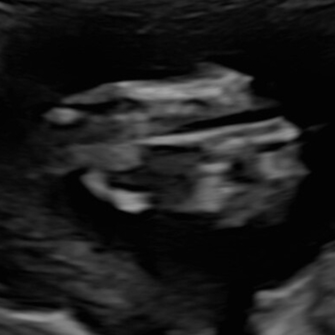 Photo shared by Kat for their Babylist baby registry.