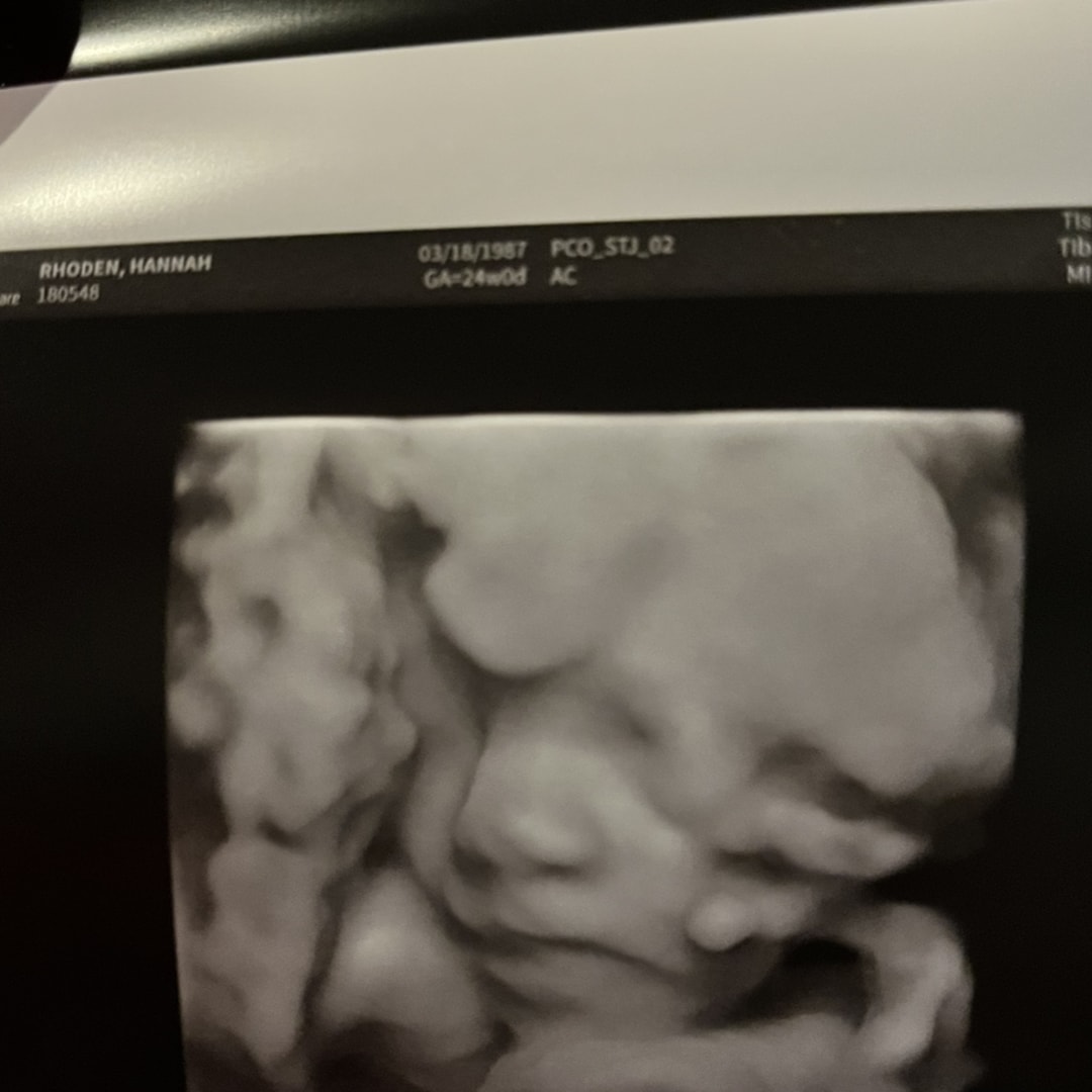 Photo shared by Hannah for their Babylist baby registry.