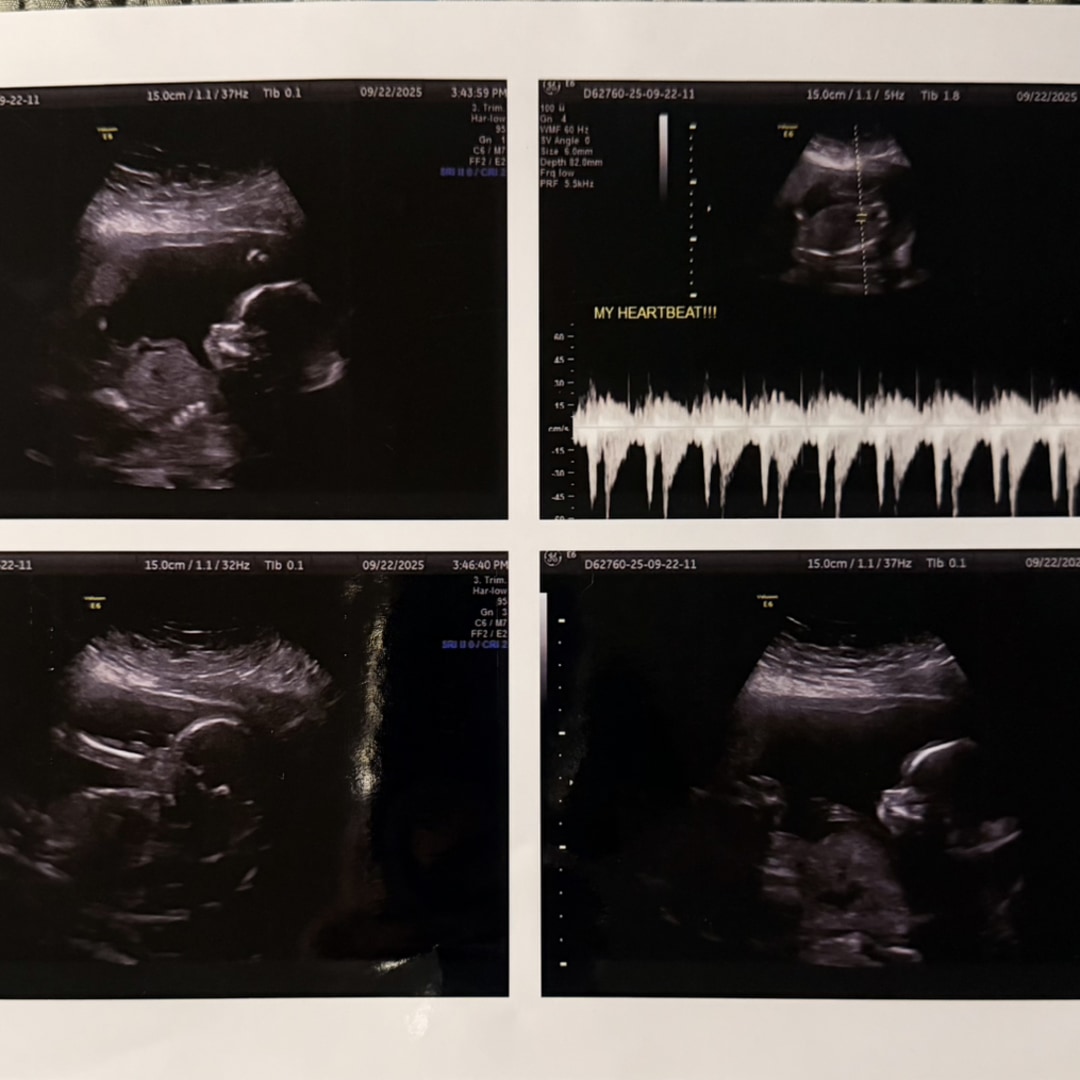 Photo shared by Ilse for their Babylist baby registry.