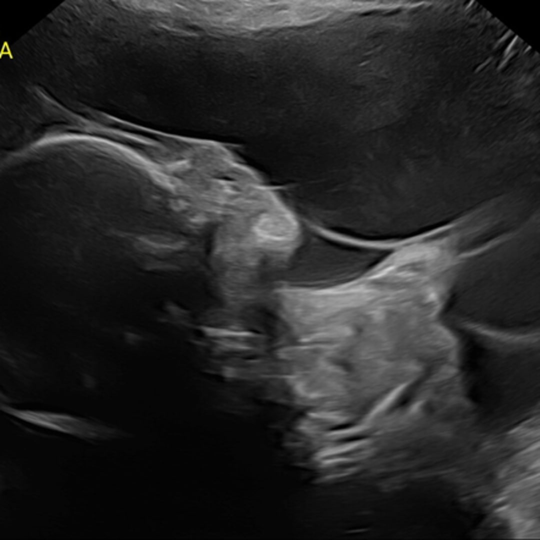 Photo shared by Alexia for their Babylist baby registry.