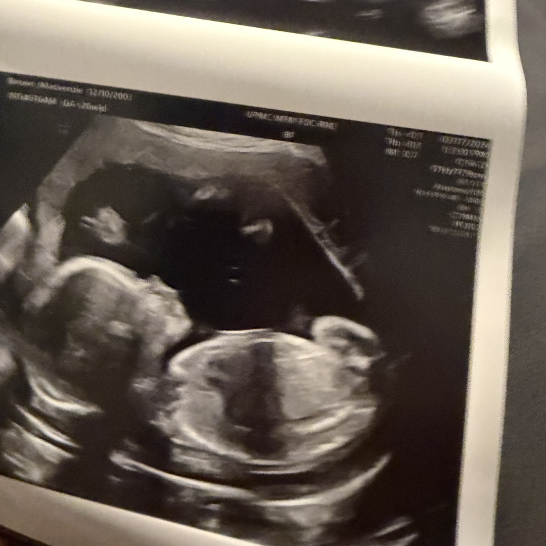 Photo shared by Mackenzie for their Babylist baby registry.