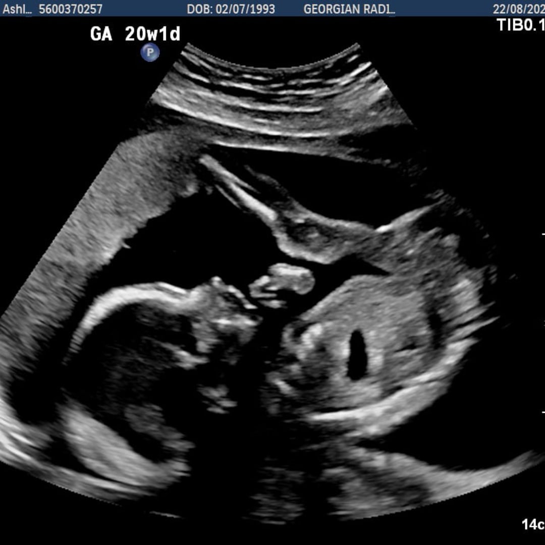 Photo shared by Ash for their Babylist baby registry.
