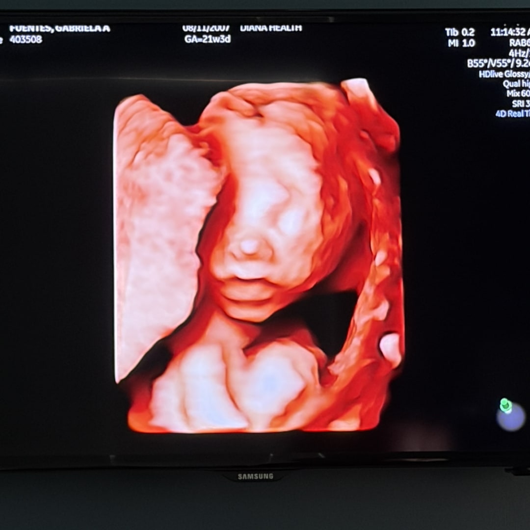 Photo shared by Gabriela for their Babylist baby registry.