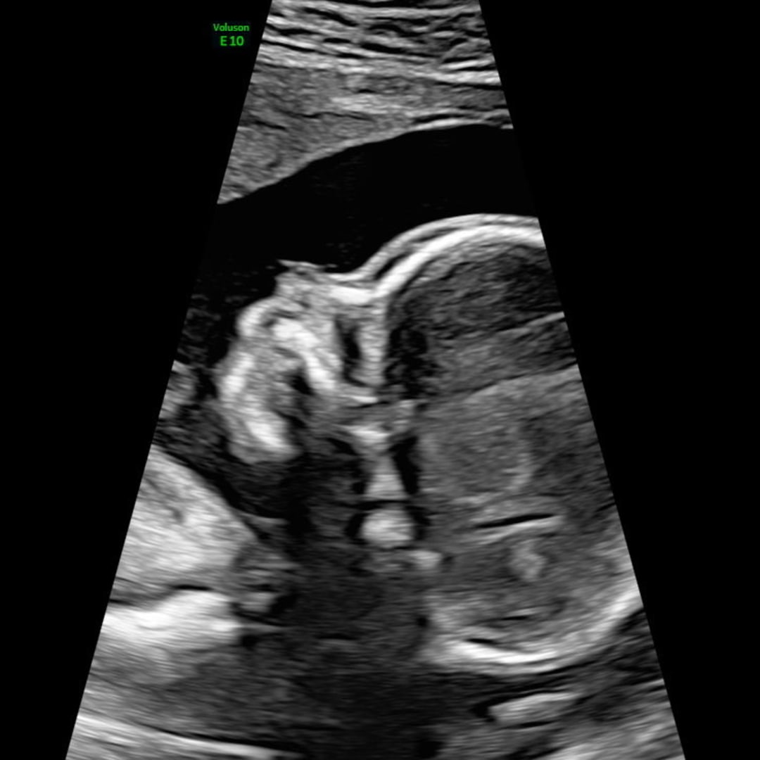 Photo shared by Kristine for their Babylist baby registry.