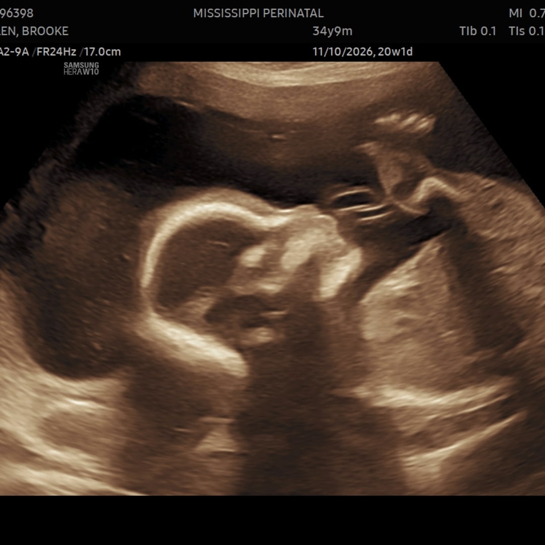 Photo shared by Brooke for their Babylist baby registry.