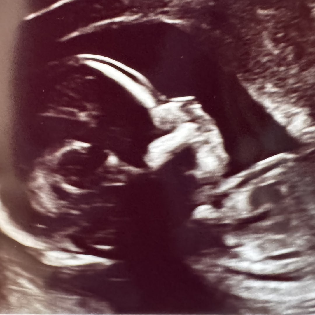 Photo shared by Dierk & Annie for their Babylist baby registry.
