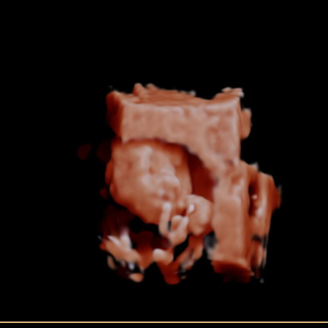 Photo shared by Erin for their Babylist baby registry.