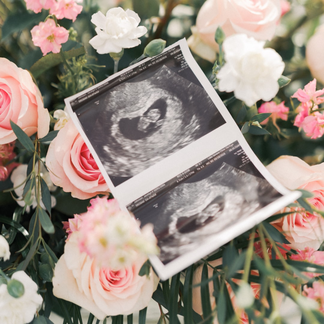 Photo shared by Jacelyn for their Babylist baby registry.