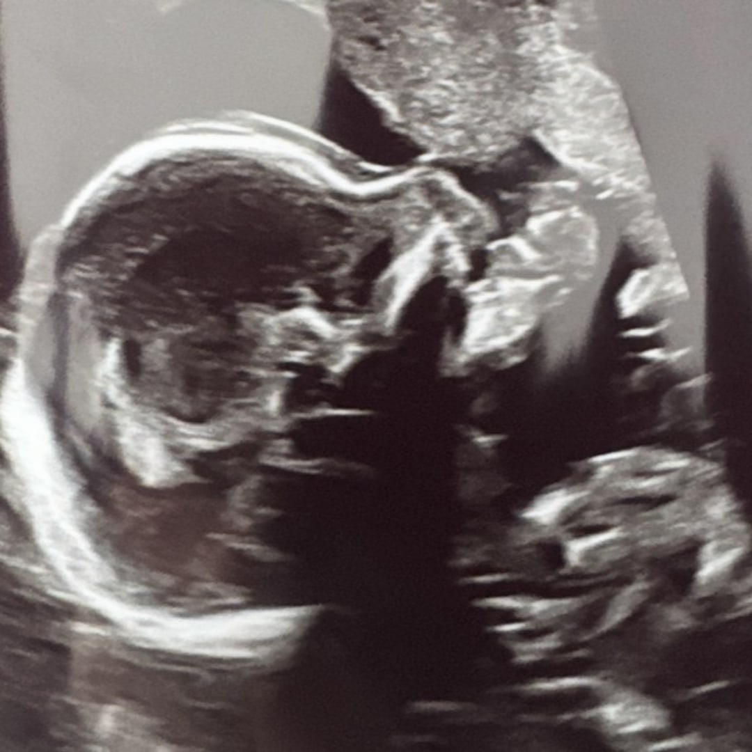 Photo shared by Sierra for their Babylist baby registry.