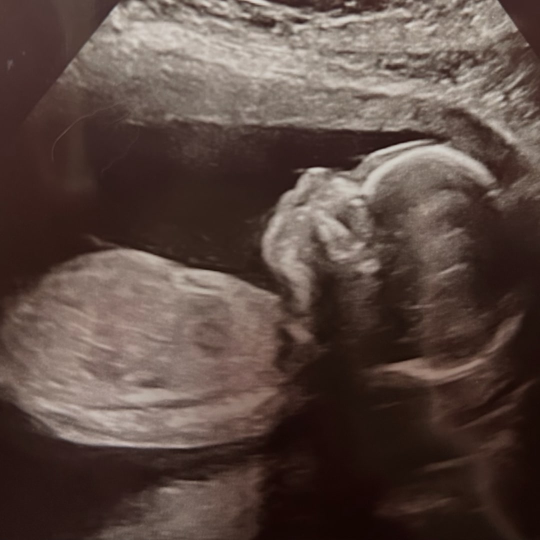 Photo shared by Hannah for their Babylist baby registry.