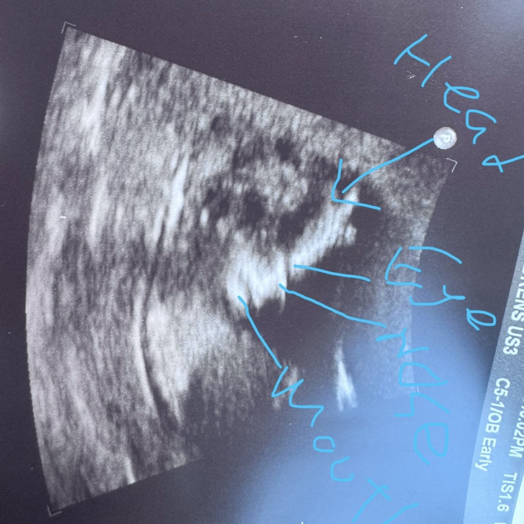 Photo shared by Kerri for their Babylist baby registry.