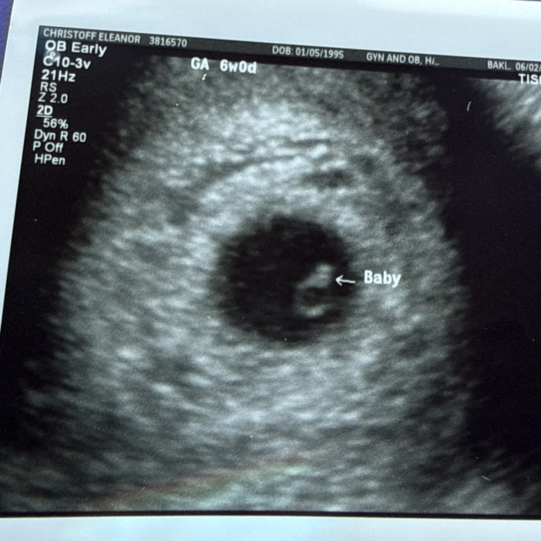 Photo shared by Eleanor for their Babylist baby registry.